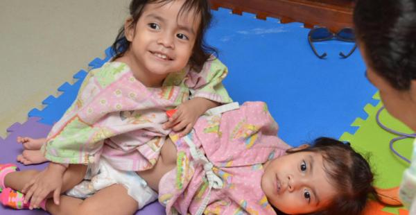 Читать Врачи успешно разделили сиамских близнецов в Гватемале