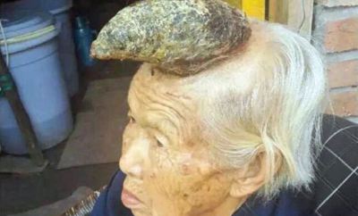 Огромный рог вырос на голове китаянки