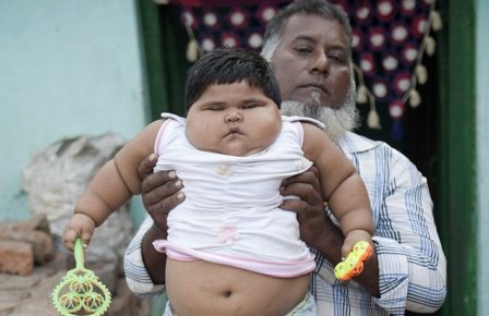 18-месячная девочка весит как 8-летний ребенок
