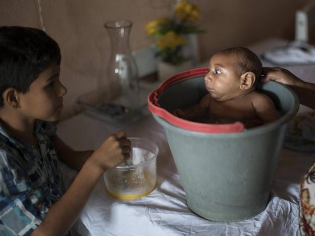 В Бразилии вирус Зика мог изуродовать 4,3 тысяч младенцев