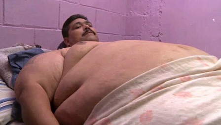 Читать Крайне толстому мексиканцу урежут желудок