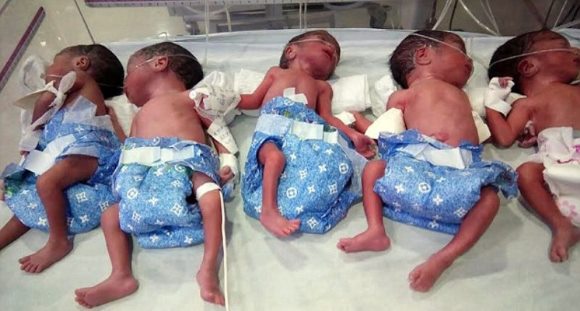 В Индии женщина родила пятерых, хотя думала, что беременна всего одним ребенком
