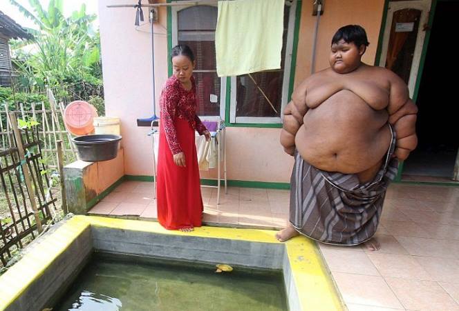 Самый толстый ребенок в мире весит 192 кг