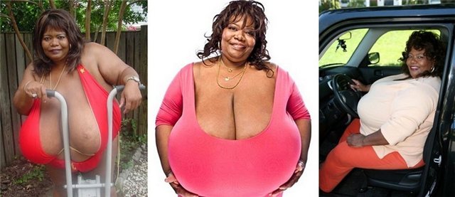 Женщина с самой большой грудью в мире не думает о пластике