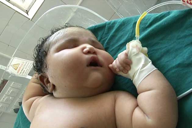 В Индии родилась самая тяжелая девочка, младенец весит 6,8 кг