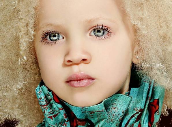Афроамериканка-альбинос стала новой необычной моделью