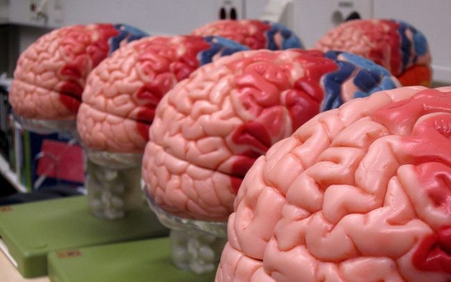 Читать Московские психологи описали новый синдром поражения мозга
