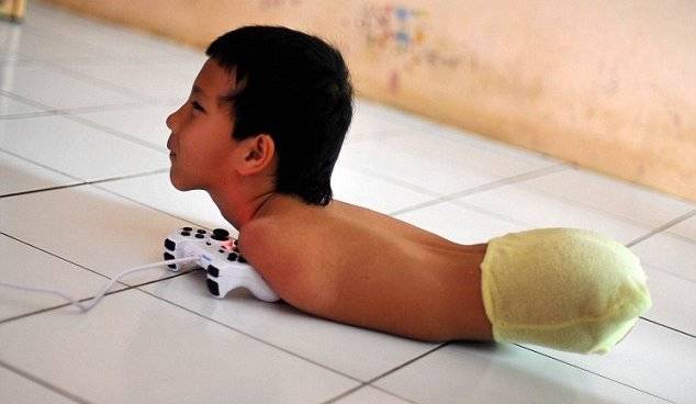 Рожденный без рук и без ног мальчик научился играть на видеоприставке