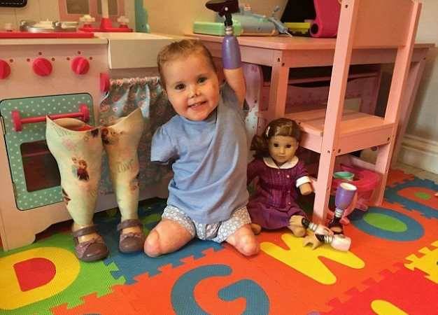 Девочке без рук и ног подарили такую же куклу