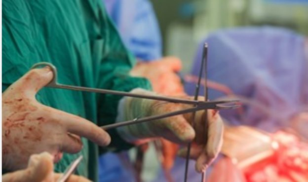 Кемеровские хирурги вытащили из кишечника девочки клубок волос