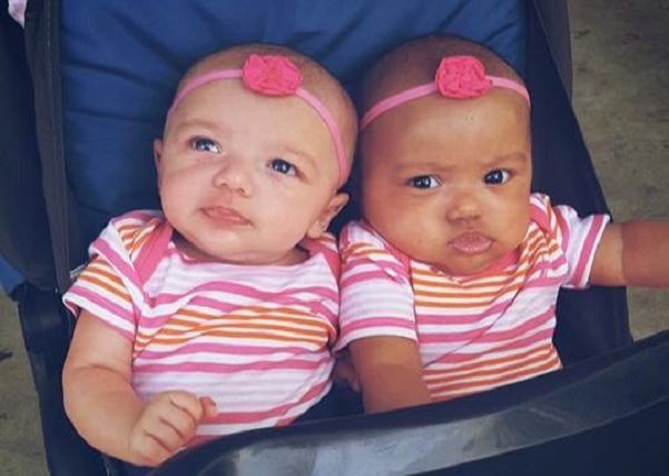 В США родились близнецы с разным цветом кожи