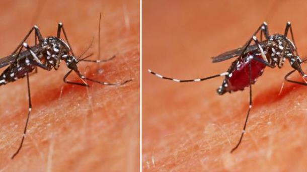 В Германии из-за укуса комара женщина лишилась ног и одной руки