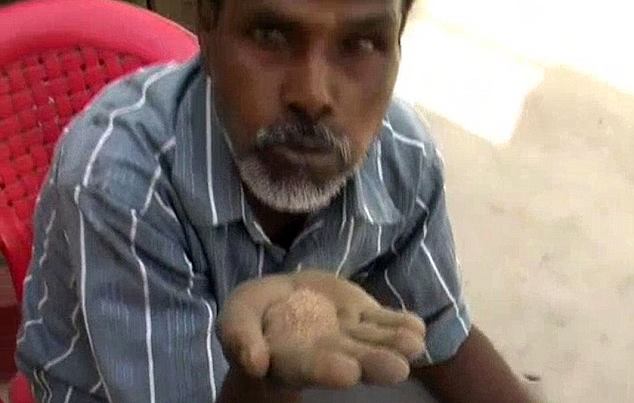 45-летний индиец обожает есть песок и кирпичи