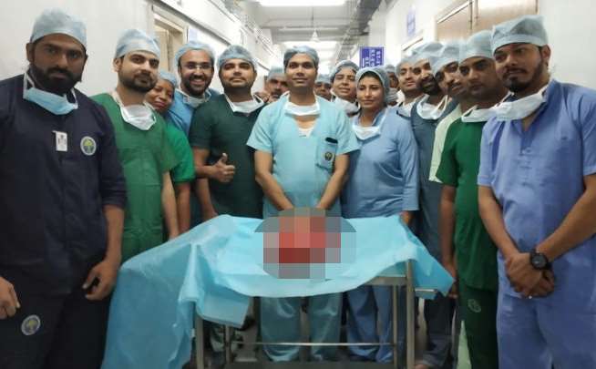 Индийские хирурги удалили самую большую в мире опухоль почки (Осторожно, шокирующий контент!)